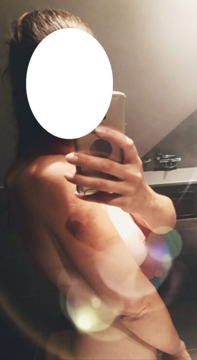 afera sa lepom ženom